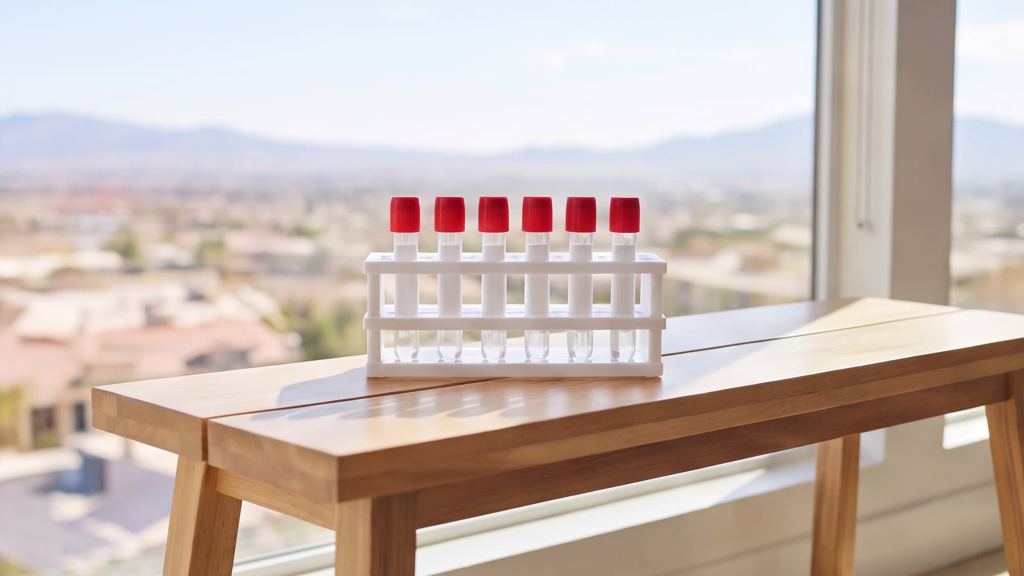 A white rack of sealed sample tubes with red caps on a wooden table in front of a sunny window over the valley
